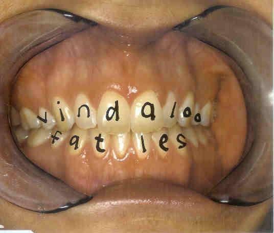 Fat Les - Vindaloo